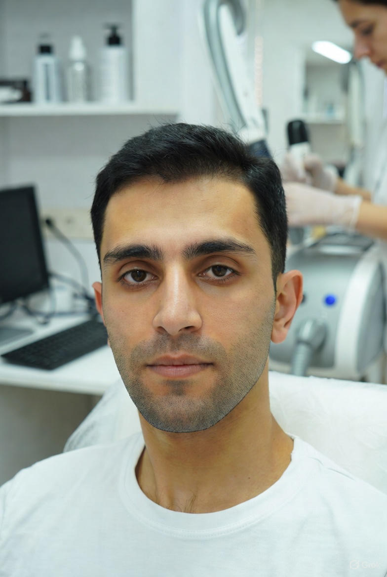 لیزر آقایان کرج