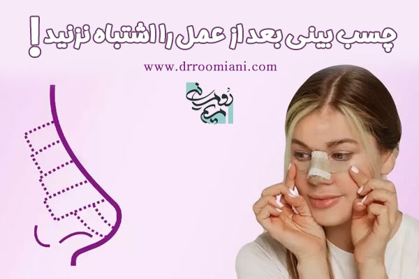 چسب زدن به بینی بعد از عمل | دکتر مریم رومیانی