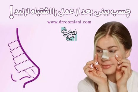 چسب بینی بعد از عمل را اشتباه نزنید !