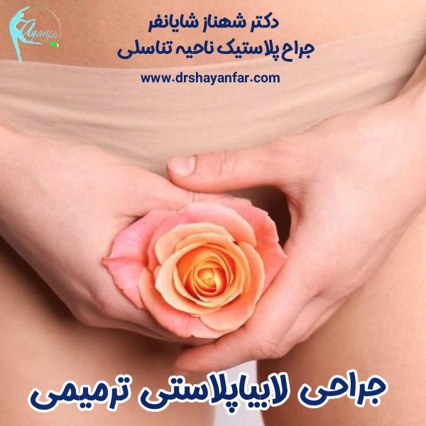جراحی ترمیمی لابیاپلاستی