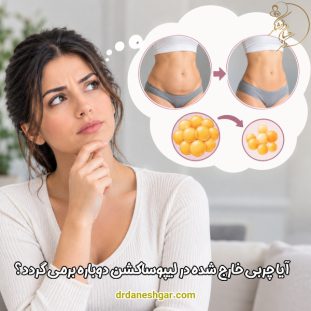 آیا چربی خارج شده در لیپوساکشن دوباره برمی گردد؟