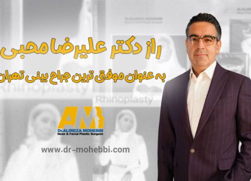 راز دکتر علیرضا محبی به عنوان موفق‌ ترین جراح بینی تهران
